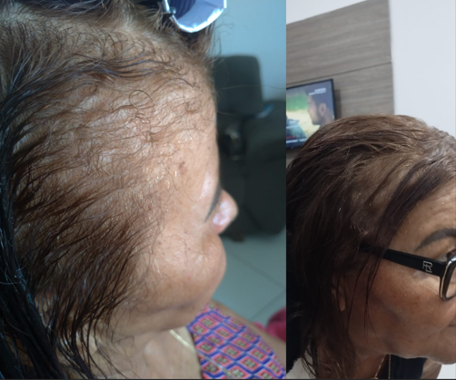 Resultado antes e depois